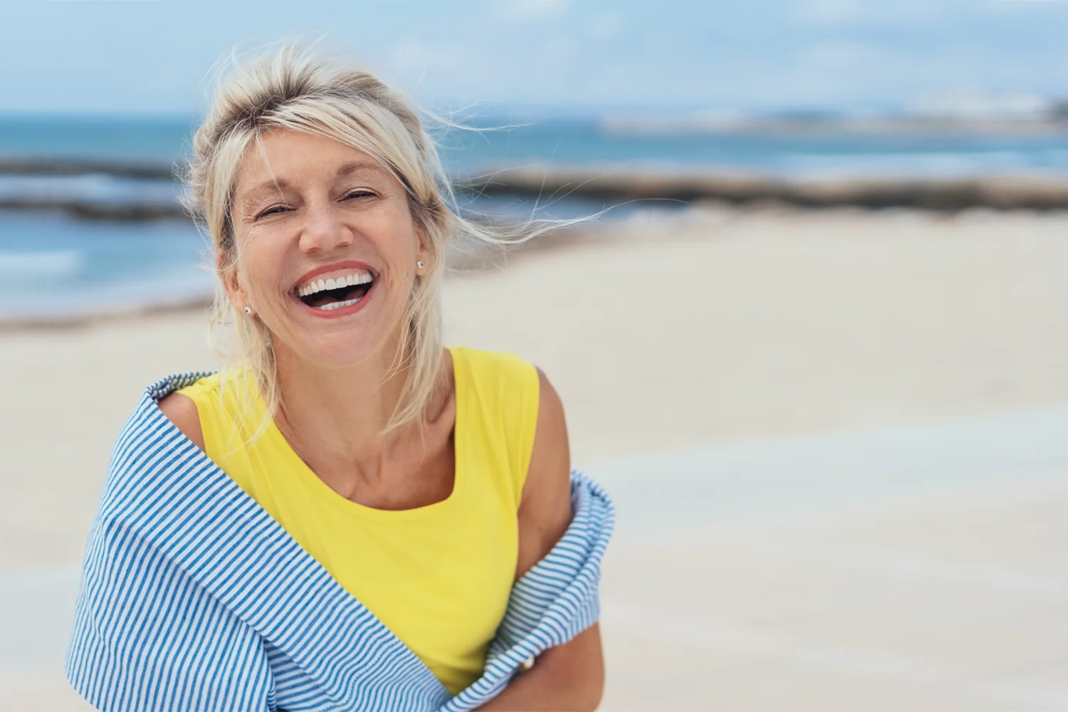 Browlift patient of Carlin Plastic Surgery, West Columbia SC