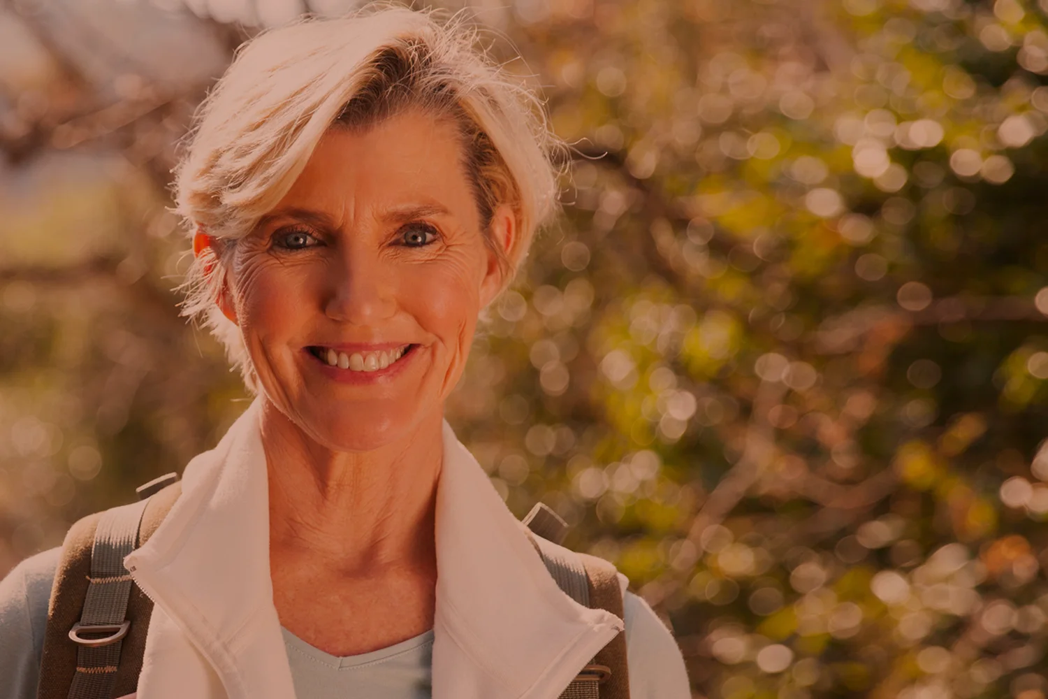 facelift patient of Carlin Plastic Surgery, West Columbia SC