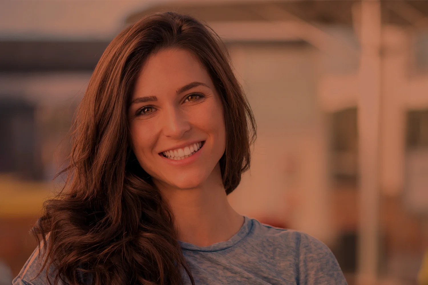 Juvéderm patient of Carlin Plastic Surgery, West Columbia SC