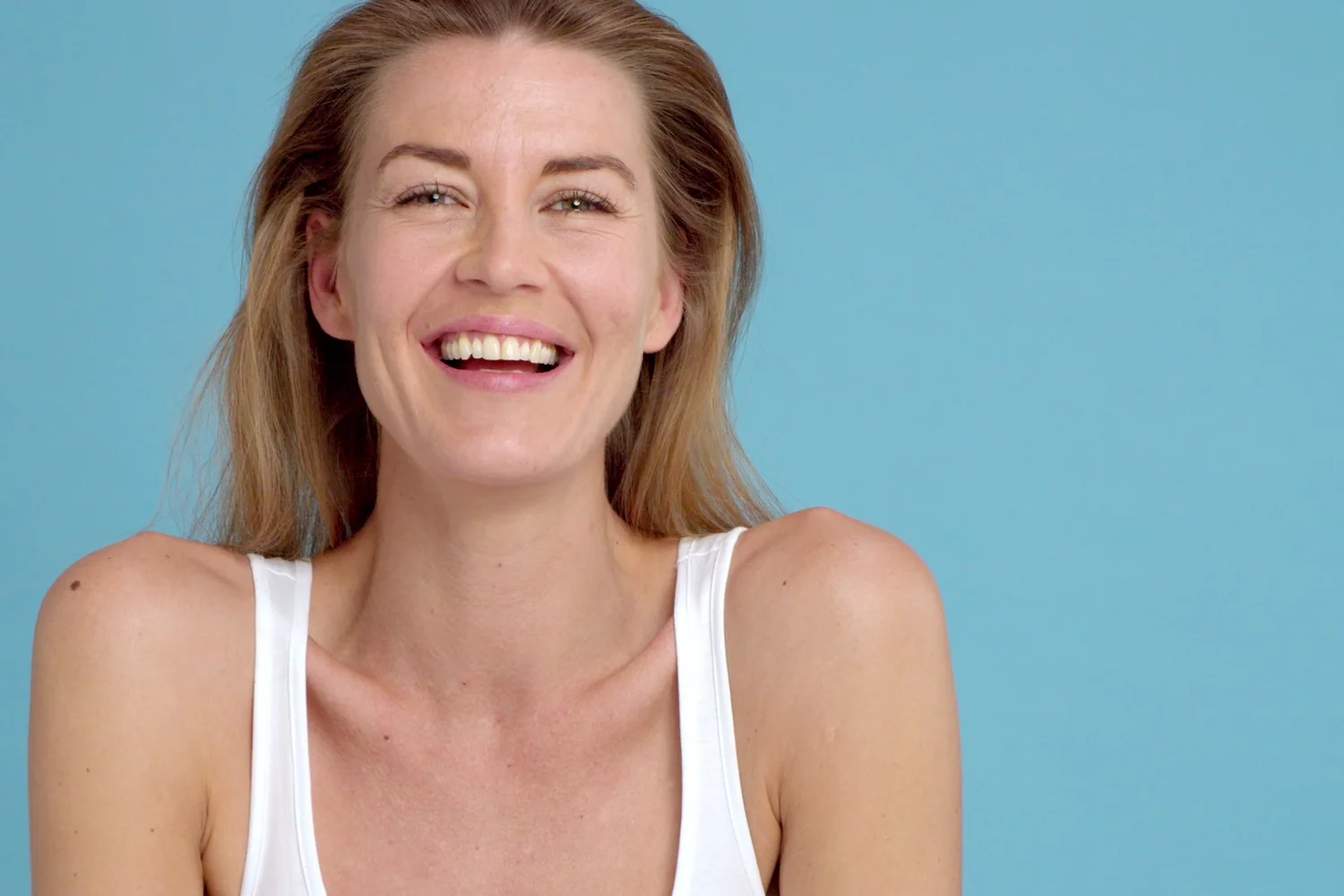 Latisse patient of Carlin Plastic Surgery, West Columbia SC